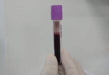 Hemopi realiza cadastro de doadores de medula óssea em 4 municípios piauienses