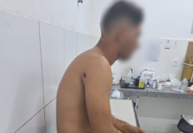 Homem de 28 anos É Baleado no Bairro Ulisses, em Cocal